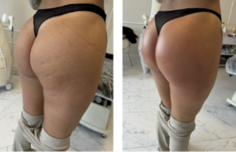 Glutes & thighs — smoothing protocol